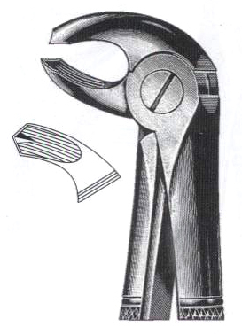 Left Lower Molars